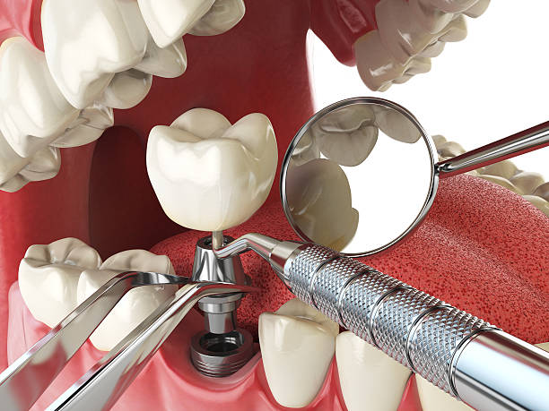 Best Emergency Treatment for Dental Infections or Abscesses in Funny River, AK